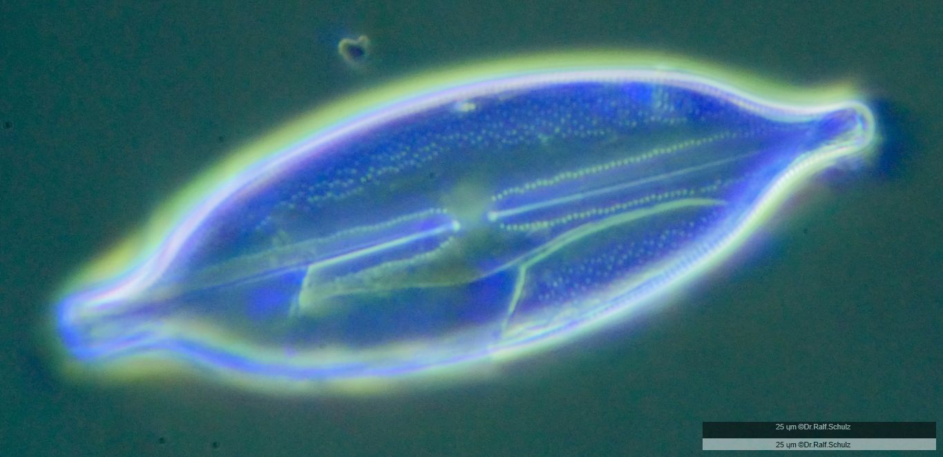 Anomoeoneis sphaerophora f. Spaerophora 20250102 Ca40ADf1p 0037 hp