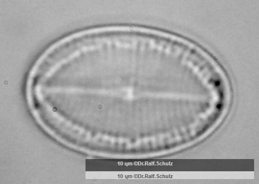 Cocconeis placentula var placentula R Schale 20250213 Ca100AHf1p 00145 hp