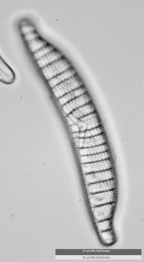 Epithemia adnata 1 20241221 Ca40AHf1p 0037 hp
