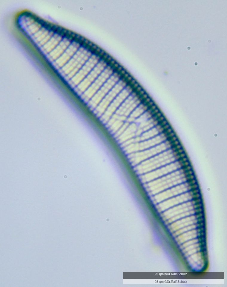 Epithemia turgida 1 20241221 Ca40AHf1p 0037 hp