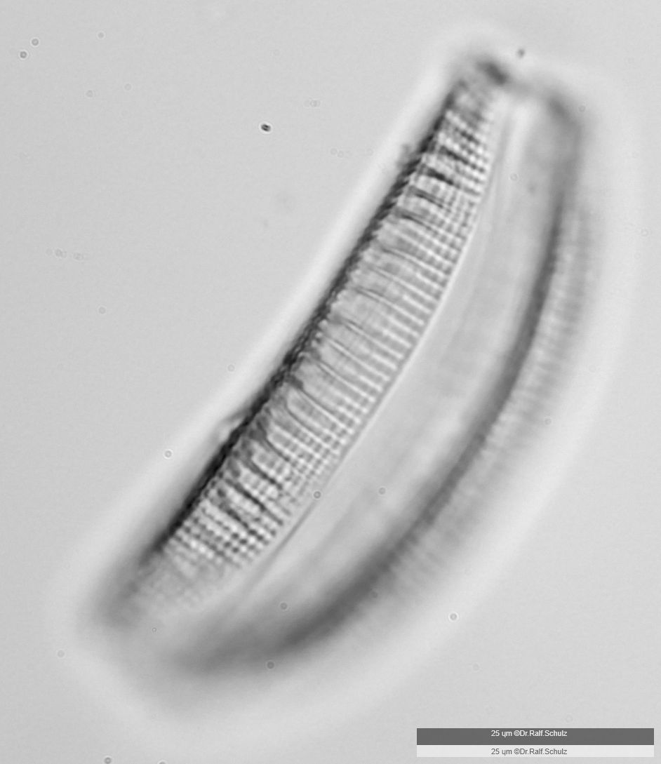 Epithemia turgida 2 Seitenansicht 20250120 Ca40AHf1p 0037 hp