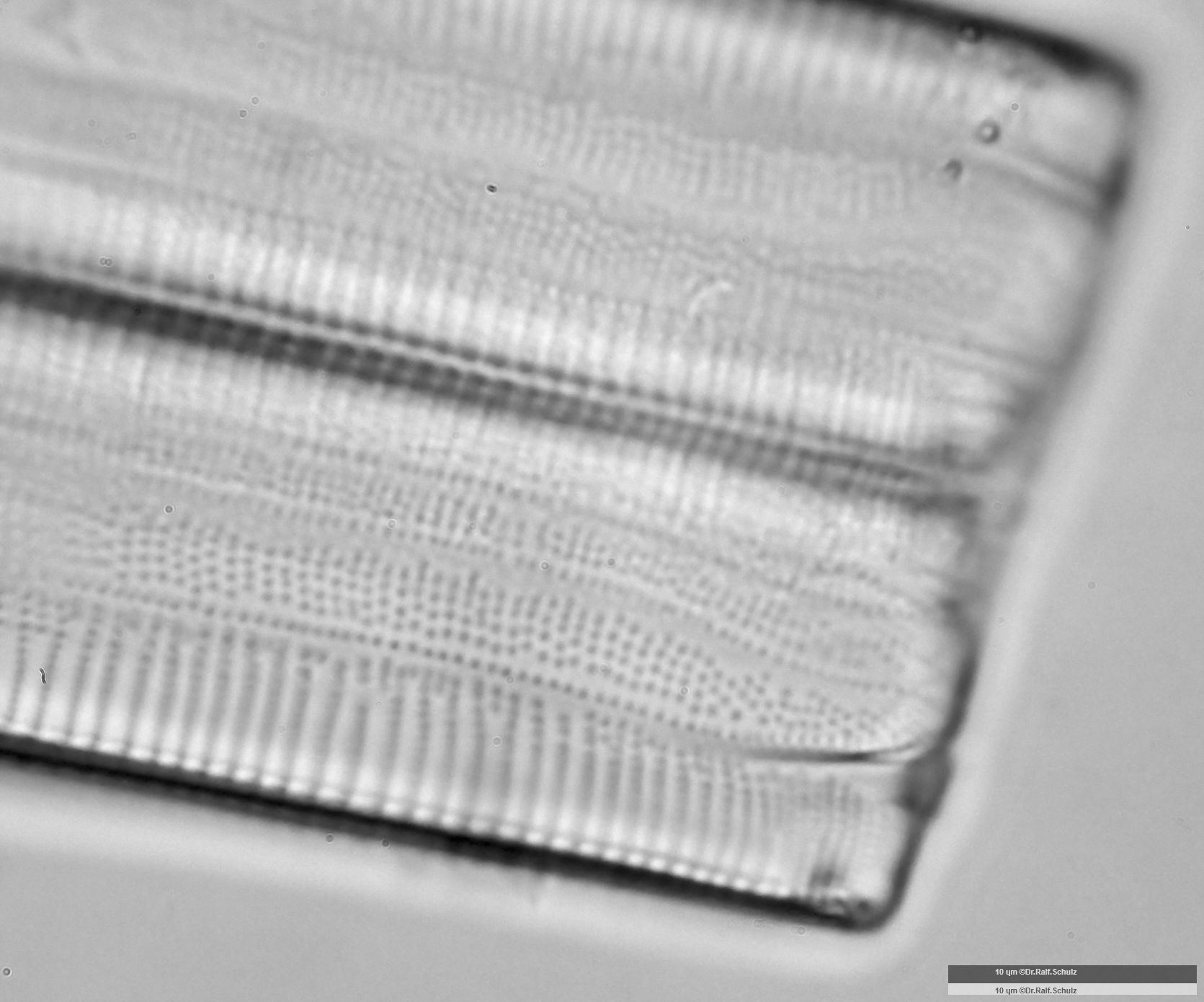 Eunotia formica 2 Gürtelsicht Raphe 20250227 Ca100AHf1p 00145 hp