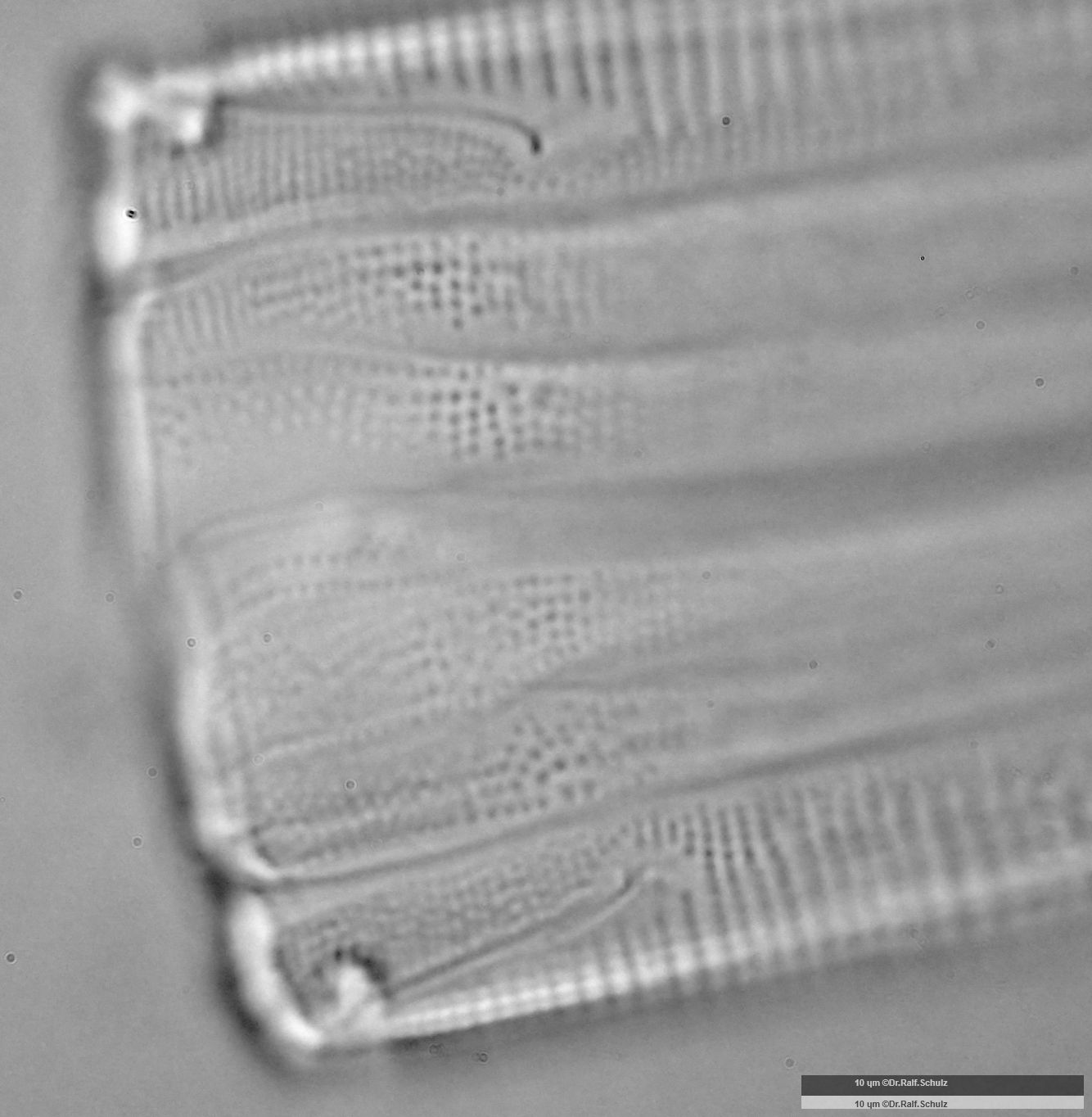 Eunotia formica 3 Gürtelsicht Raphe 20250227 Ca100AHf1p 00145 hp