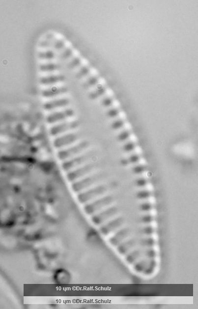 Fragilaria brevistriata 2 20250217 Ca100AHf1p 00145 hp