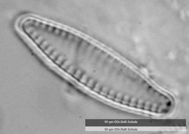 Fragilaria brevistriata Schalensicht 1 20250217 Ca100AHf1p 00145 hp