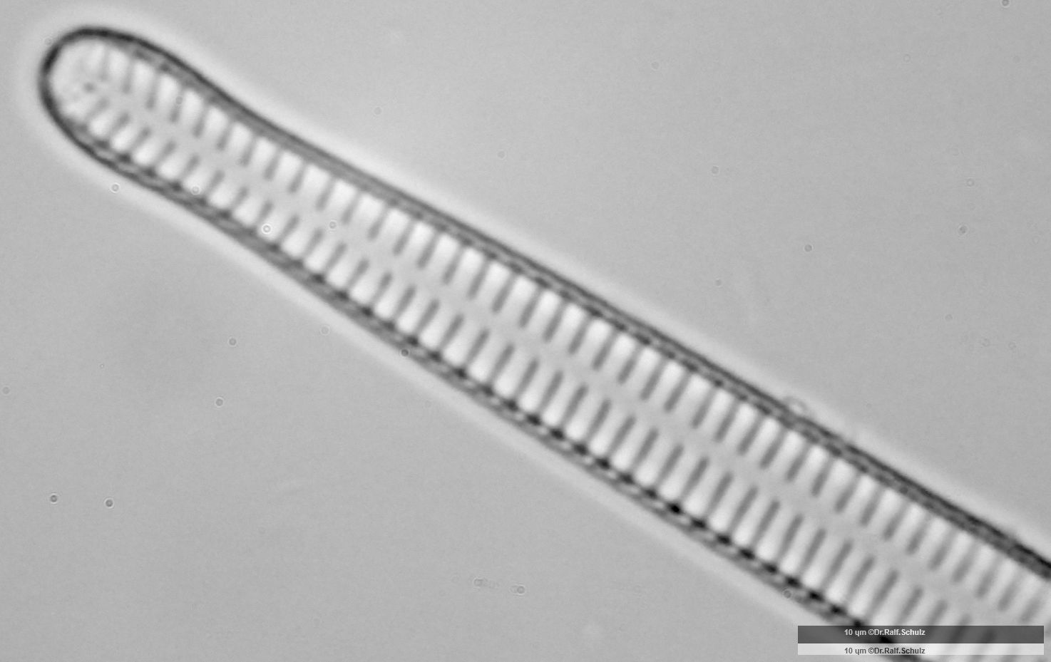 Fragilaria ulna var ulna 1 Ende 1 20250227 Ca100AHf1p 00145 hp