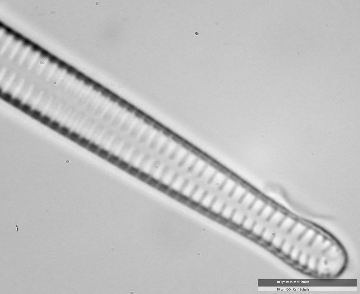 Fragilaria ulna var ulna 1 Ende 2 20250227 Ca100AHf1p 00145 hp