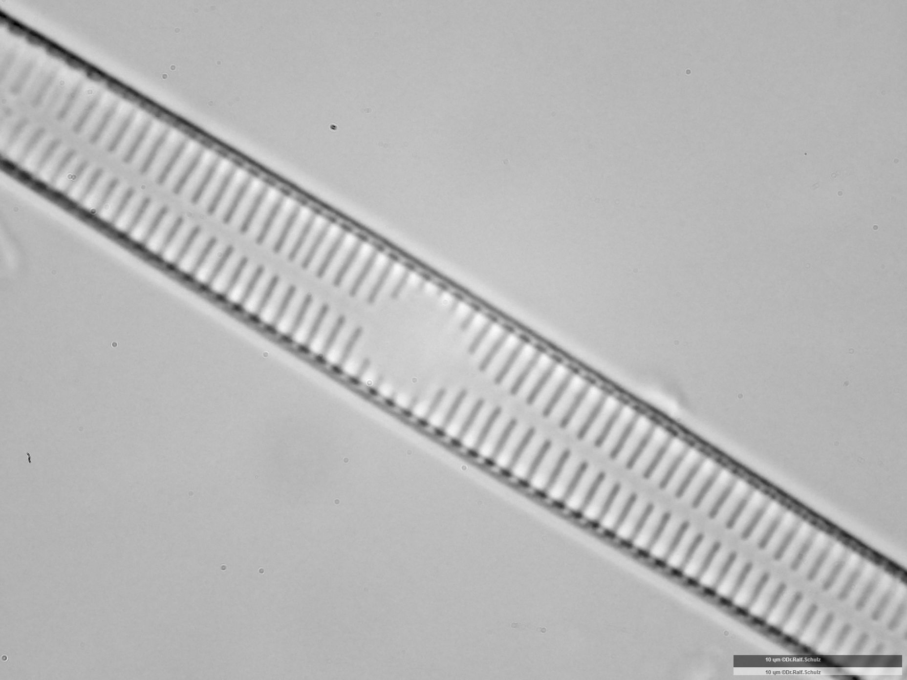 Fragilaria ulna var ulna 1 Zentralarea 20250227 Ca100AHf1p 00145 hp