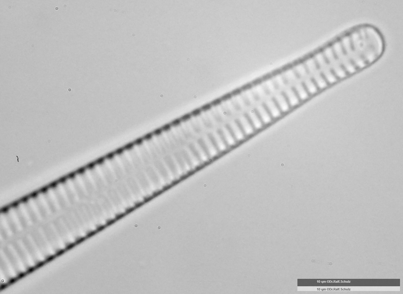 Fragilaria ulna var ulna 2 Ende 20250227 Ca100AHf1p 00145 hp