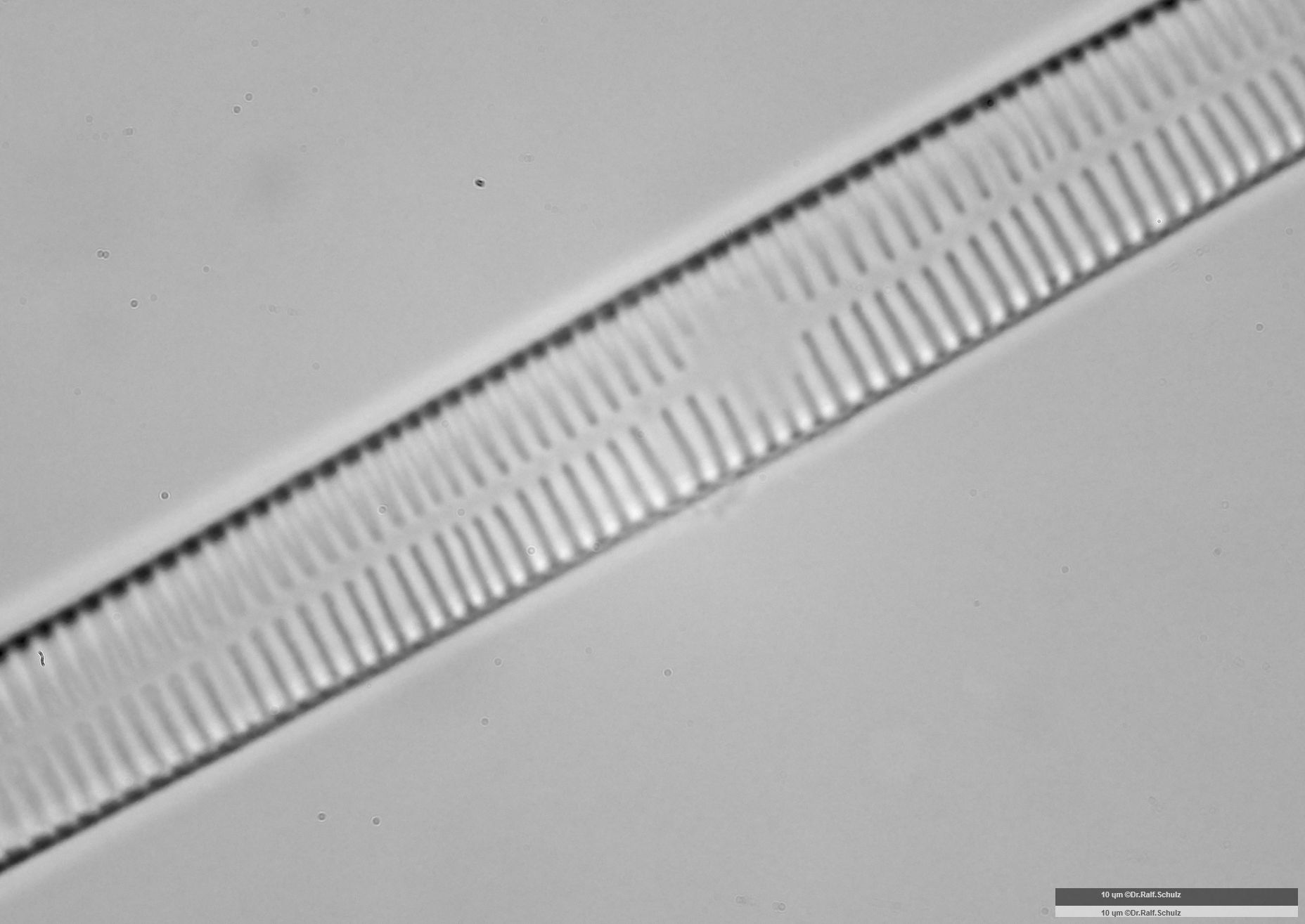 Fragilaria ulna var ulna 2 Zentralarea 20250227 Ca100AHf1p 00145 hp
