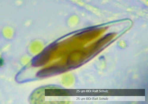 Gomphonema gracile Lebend 20250121 Ca40AHf1p 0037 hp