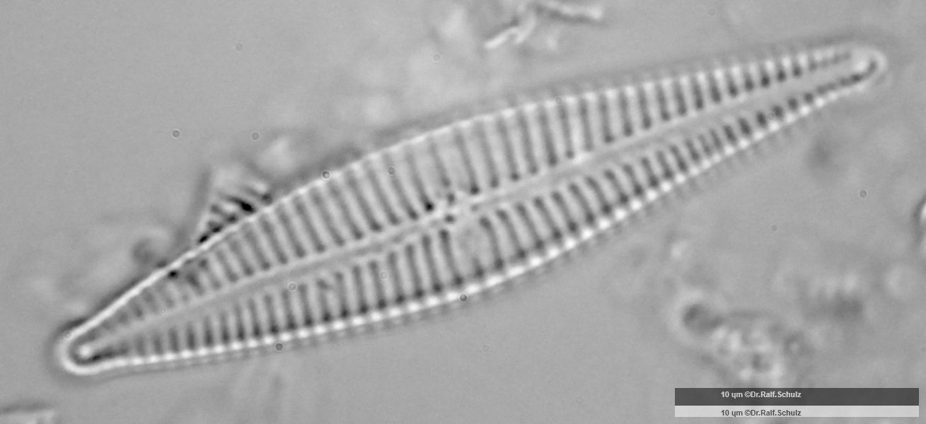 Gomphonema gracile 20250214 Ca100AHf1p 00145 hp