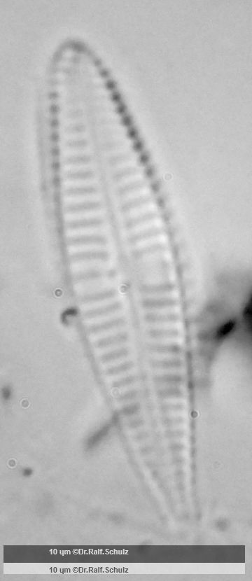 Gomphonema minutum 20250210 Ca100AHf1p 00145 hp