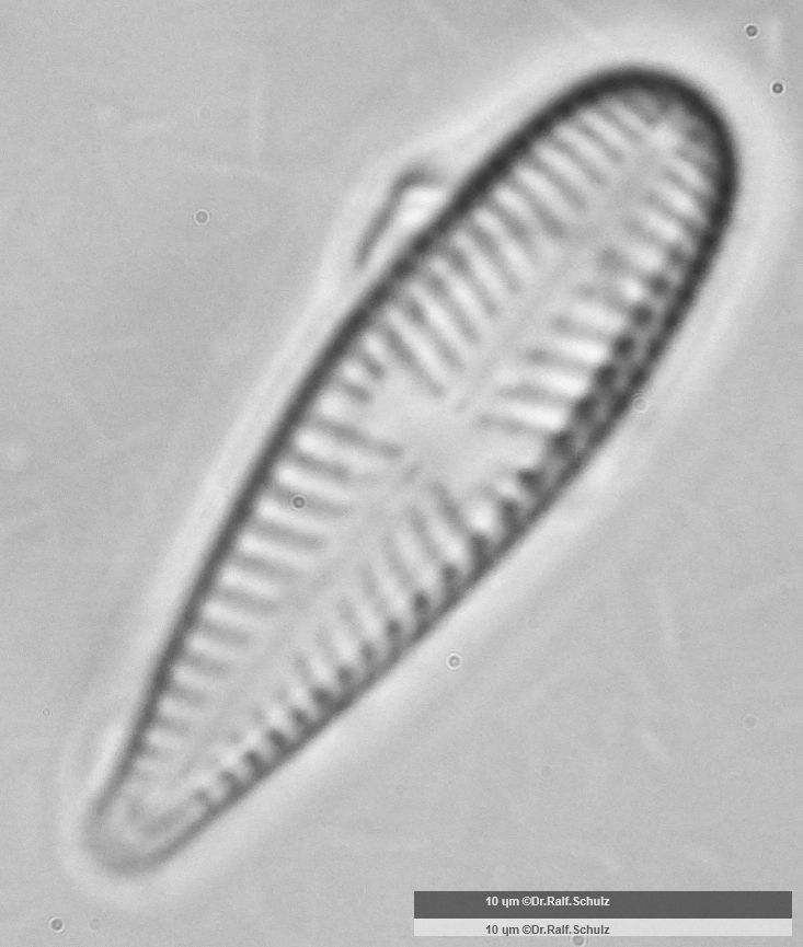 Gomphonema olivaceum 20241218 Ca100AHf1p 00145 hp