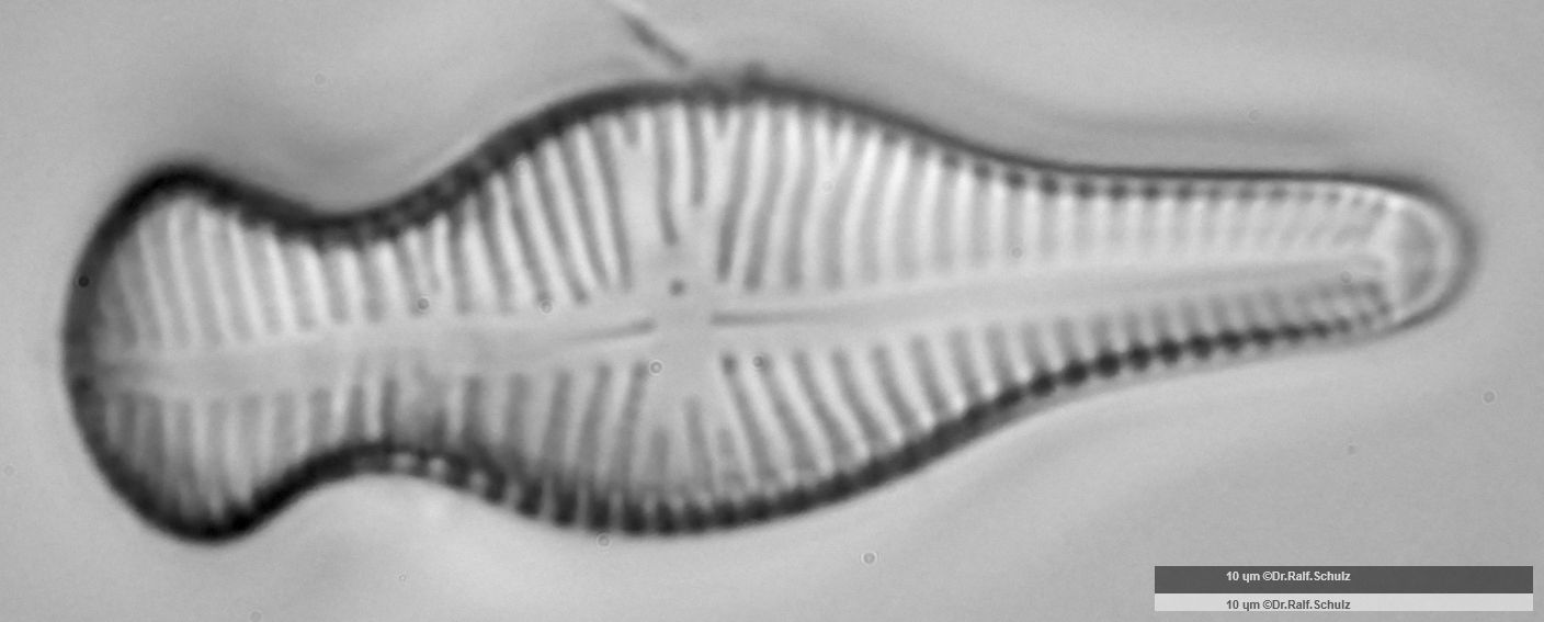 Gomphonema truncatum 1 20250314 Ca100AHf1p 00145 hp
