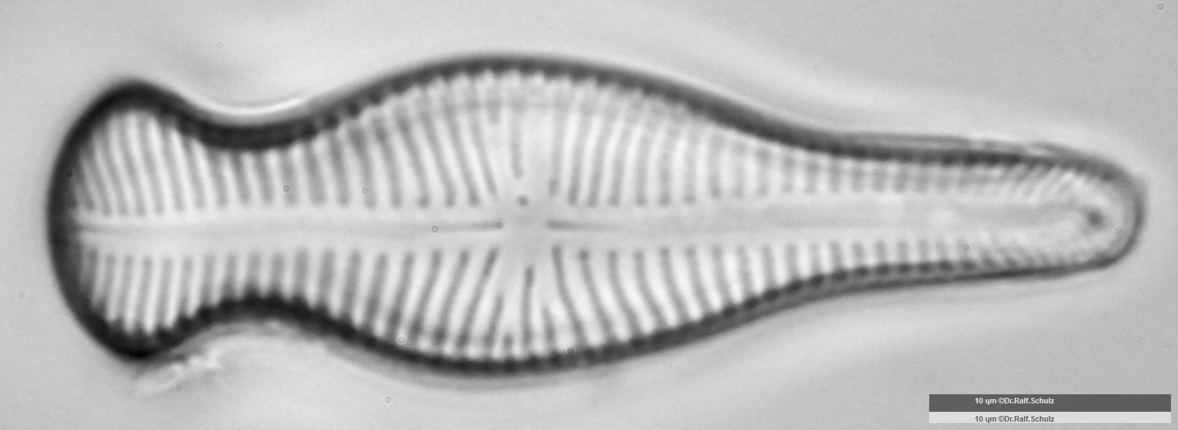 Gomphonema truncatum 2 20250314 Ca100AHf1p 00145 hp