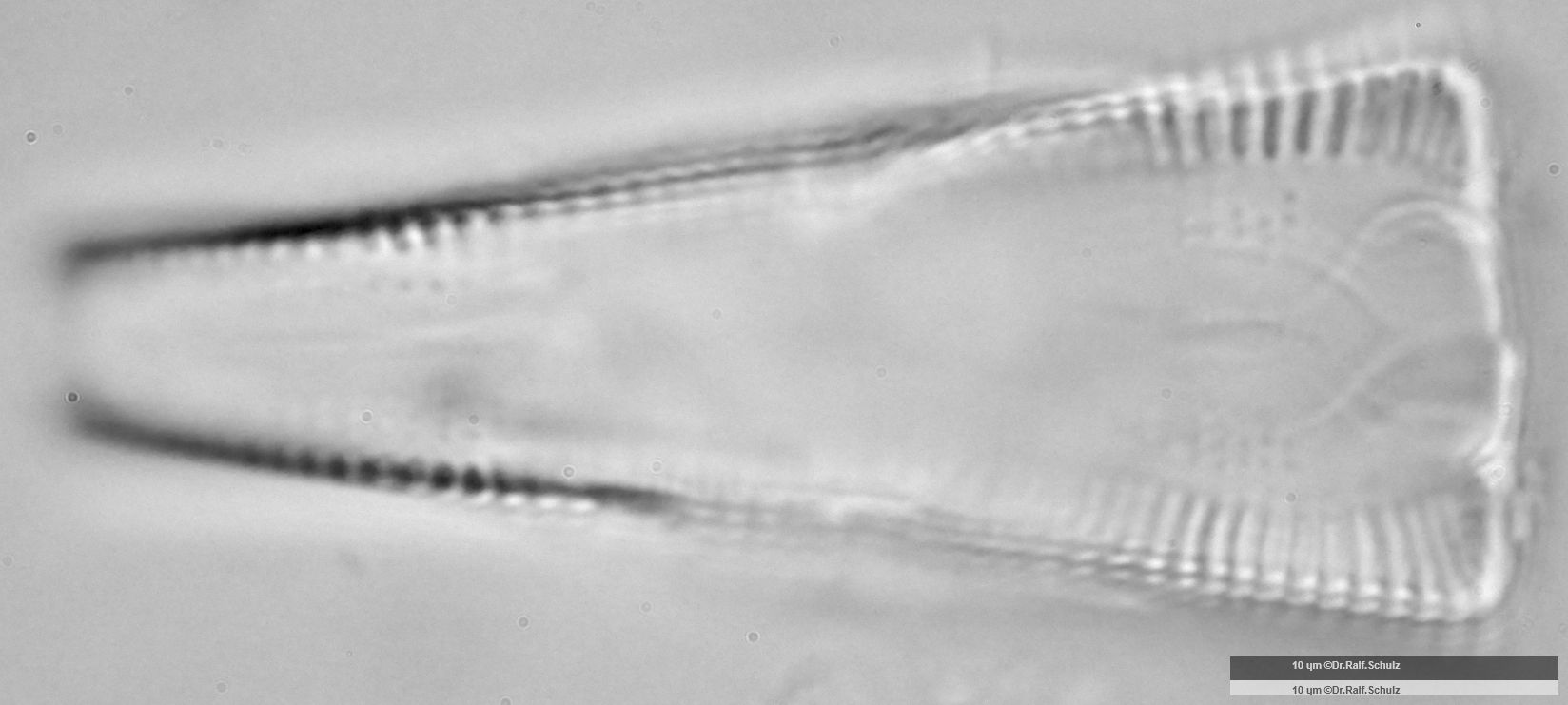 Gomphonema truncatum 3 20250314 Ca100AHf1p 00145 hp