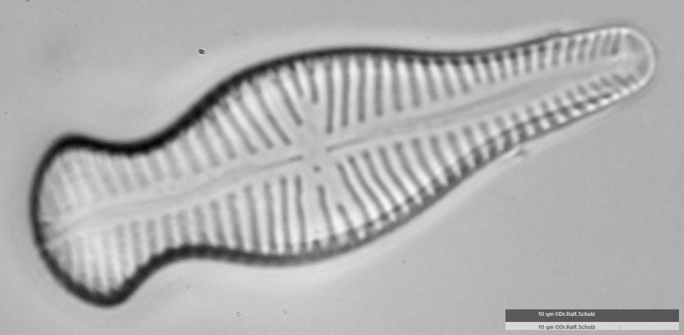 Gomphonema truncatum 4 20250314 Ca100AHf1p 00145 hp