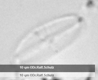 Navicula atomus 1 20250209 Ca100AHf1p 00145 hp
