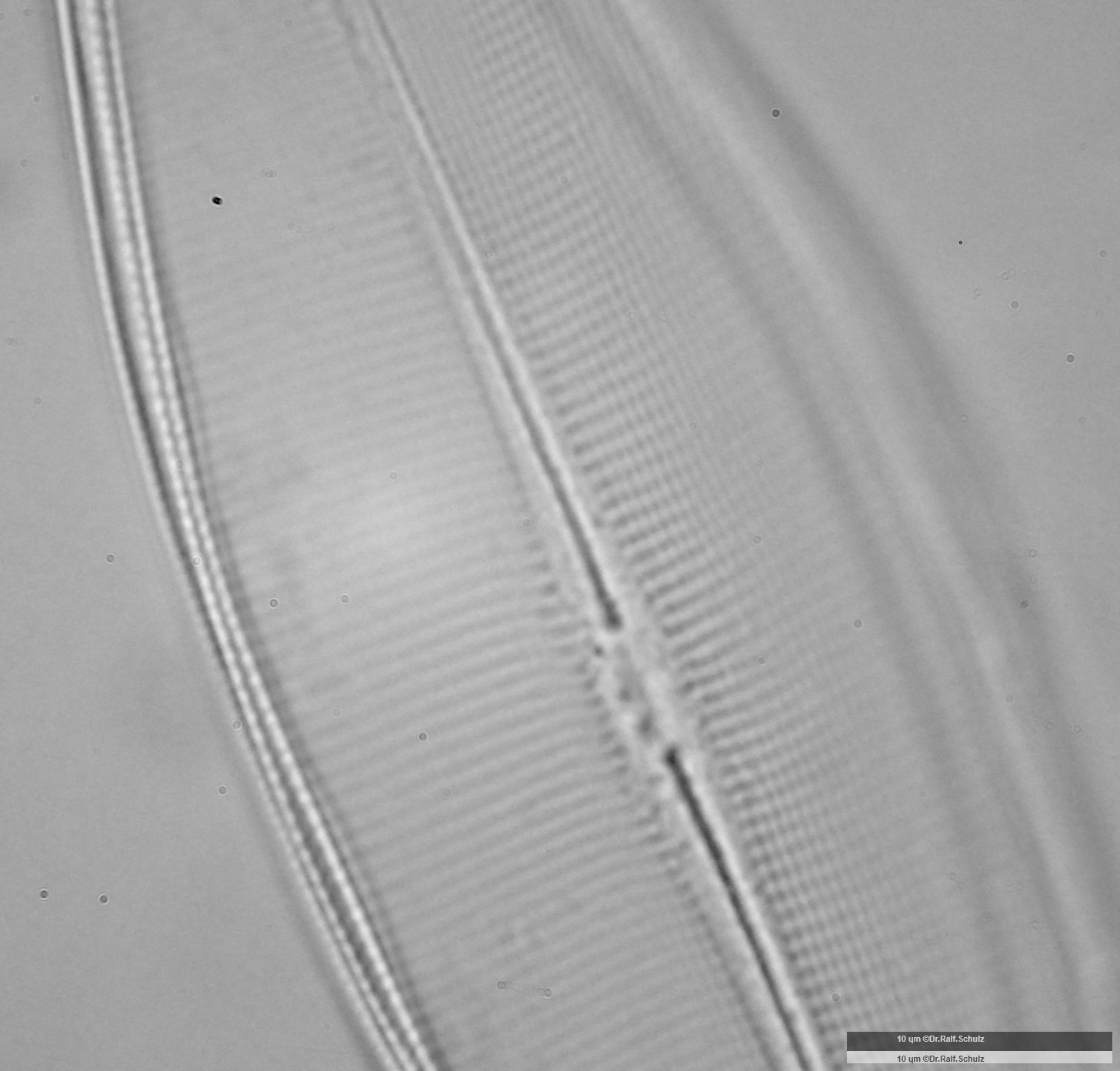 Navicula cuspidata 2 20250227 Ca100AHf1p 00145 hp
