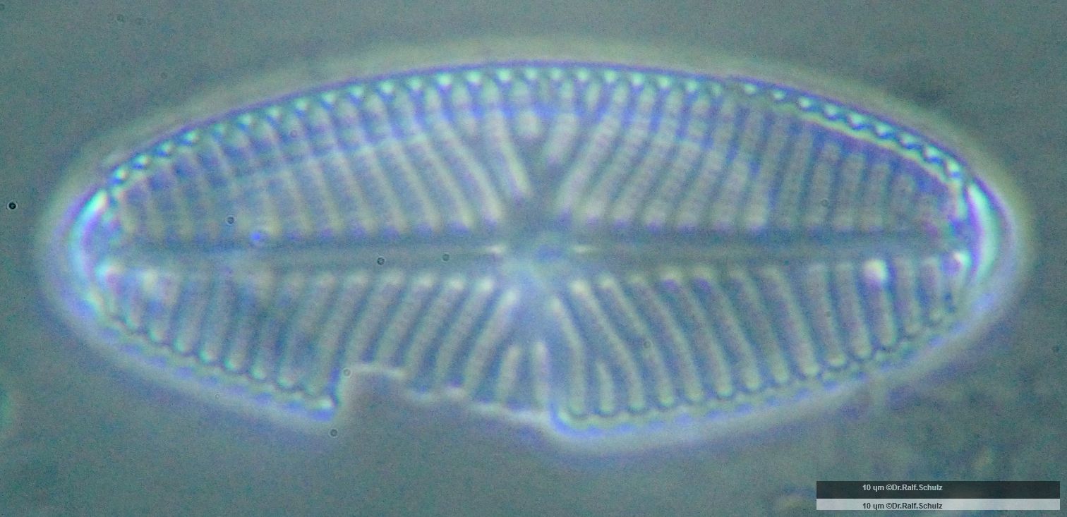 Navicula reinhardtii 20250102 Cp100APhA1p 00141 hp