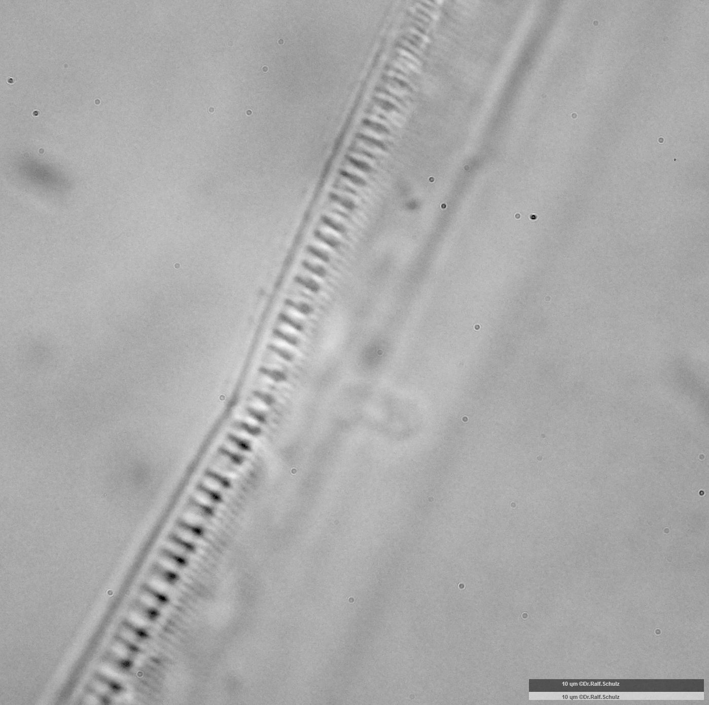 Nitzschia dubia Median 20241217 Ca100AHf1p 00145 hp
