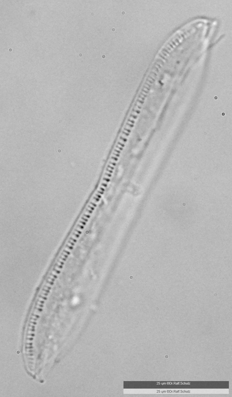 Nitzschia dubia 20241217 Ca40AHf1p 0037 hp