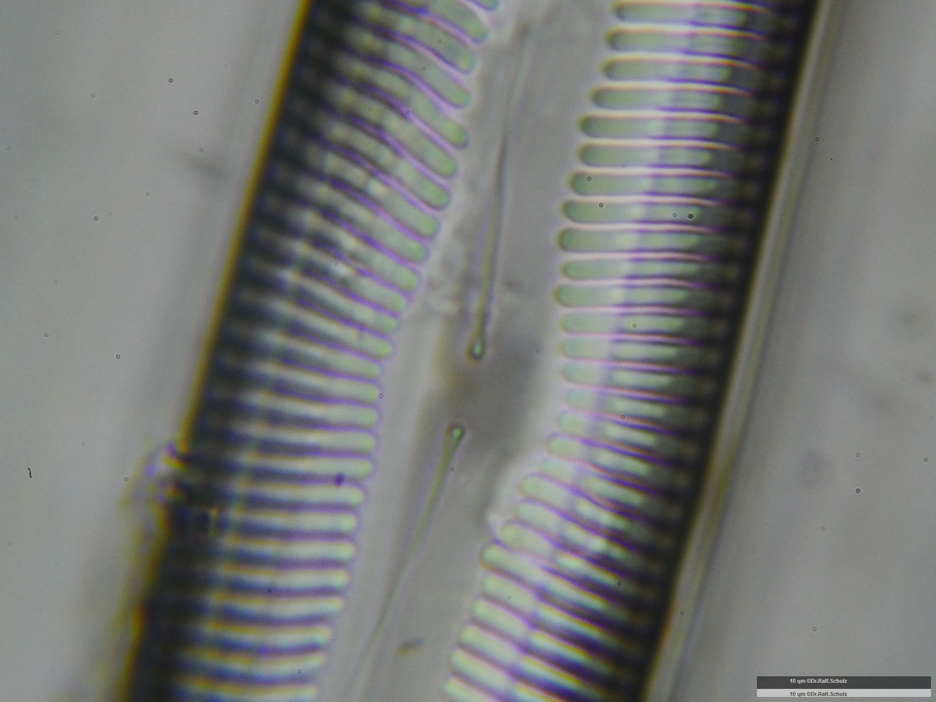 Pinnularia major Zentralarea 20241218 Ca100AHf1p 00145 hp