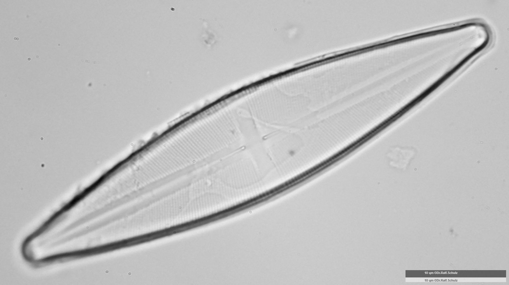 Stauroneis phoenicenteron 2 20250205 Ca100AHf1p 00145 hp