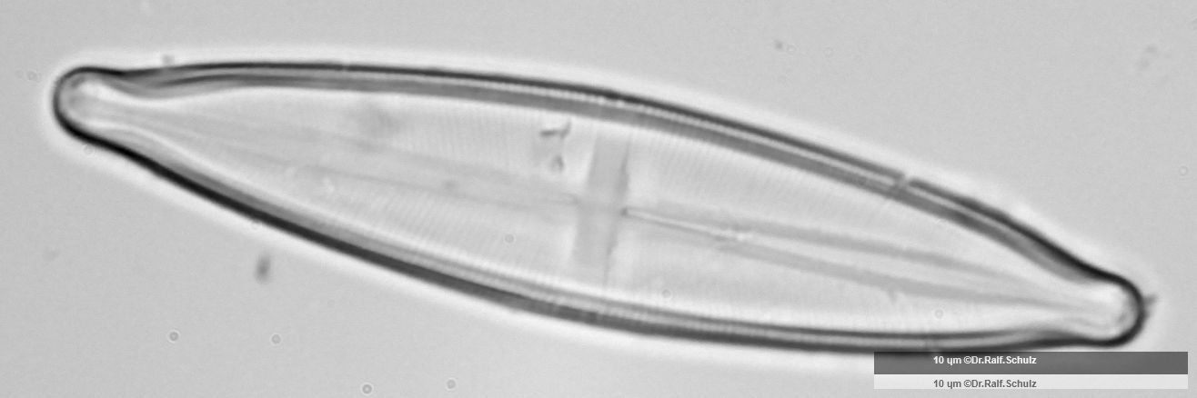 Stauroneis phoenicenteron 3 20250205 Ca100AHf1p 00145 hp