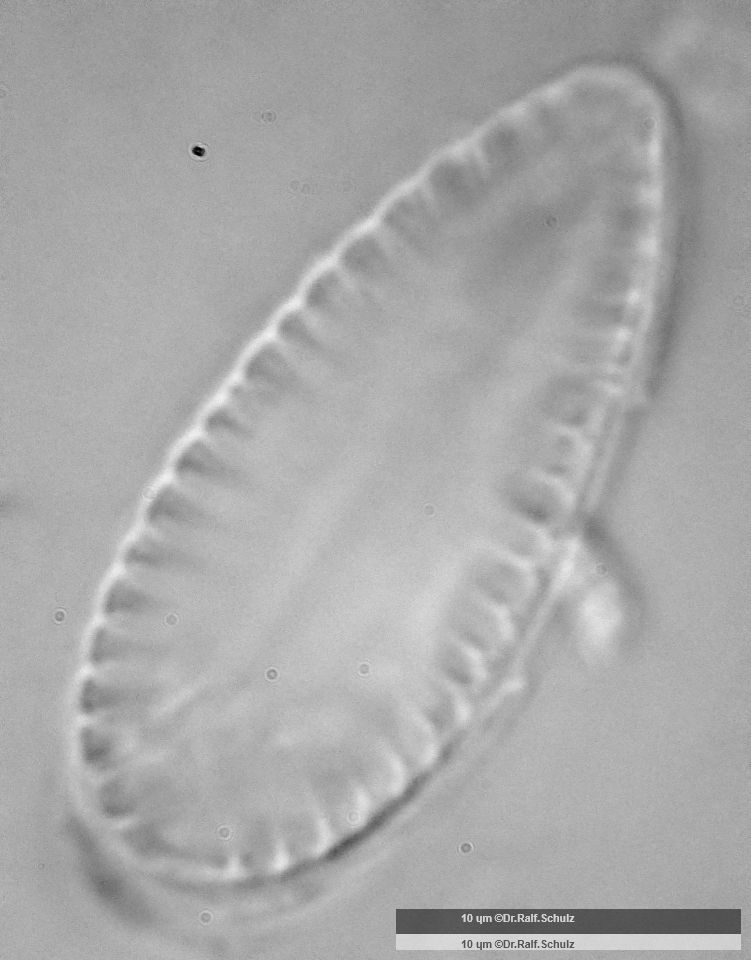 Surirella brebissonii var kuetzingii 1 20250205 Ca100AHf1p 00145 hp