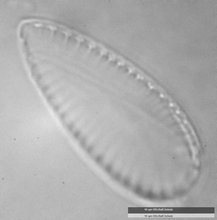 Surirella brebissonii var kuetzingii 2 20250205 Ca100AHf1p 00145 hp