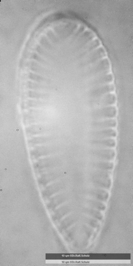 Surirella brebissonii var kuetzingii 3 20250205 Ca100AHf1p 00145 hp