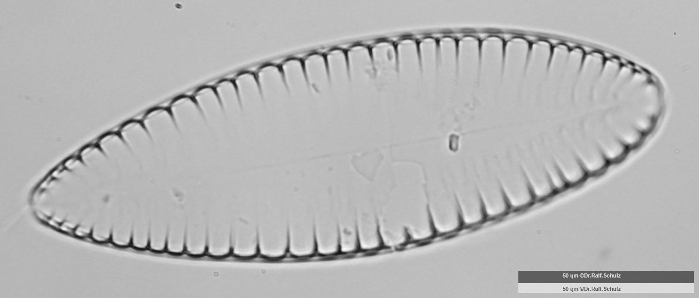 Surirella elegans 1 20250314 Ca20AHf1p 00729 hp