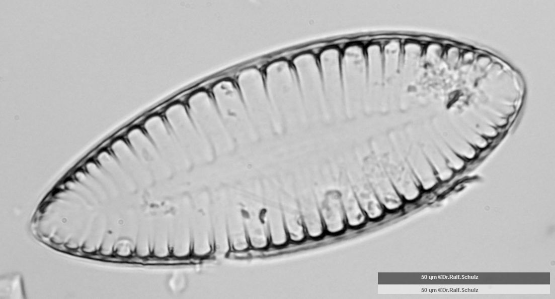 Surirella elegans 2 20250314 Ca20AHf1p 00729 hp