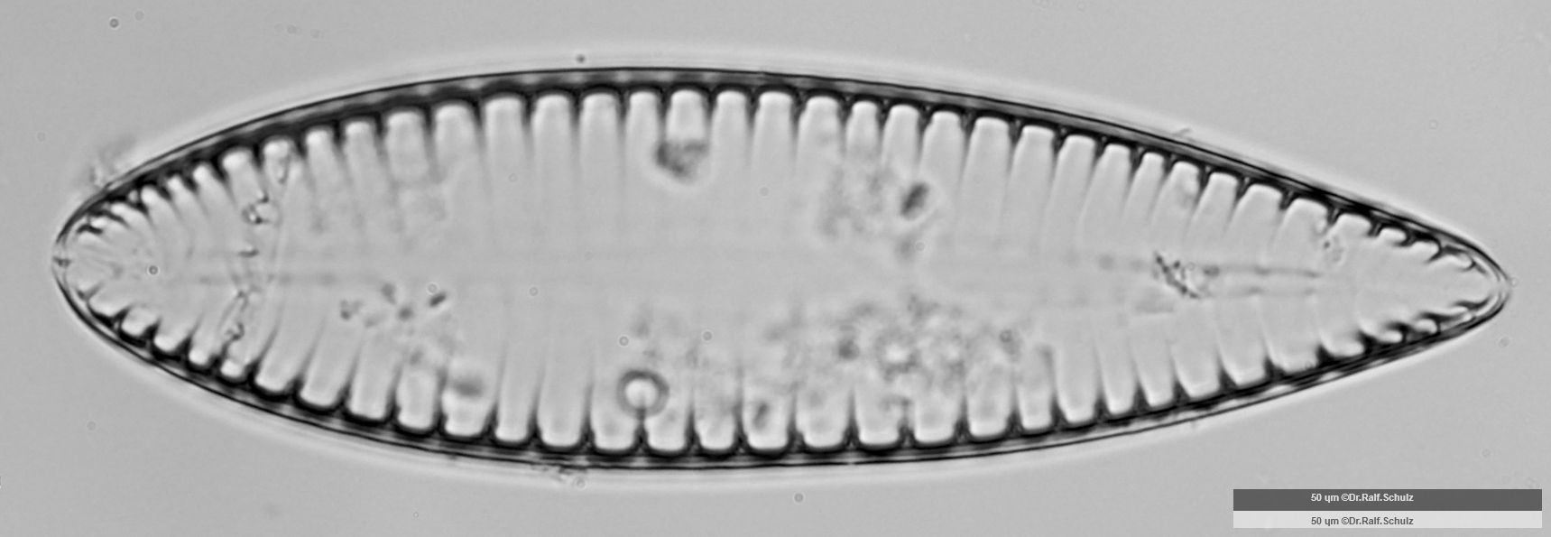 Surirella elegans 3 20250314 Ca20AHf1p 00729 hp